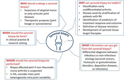 The Crucial Questions on Synovial Biopsy: When, Why, Who, What, Where, and How?